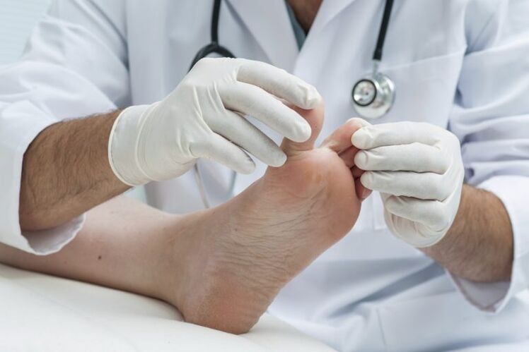 A doctor's examination with the presence of mycosis