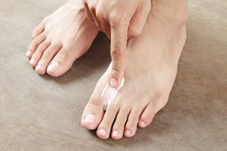 The use of antifungal creams to the skin of the feet