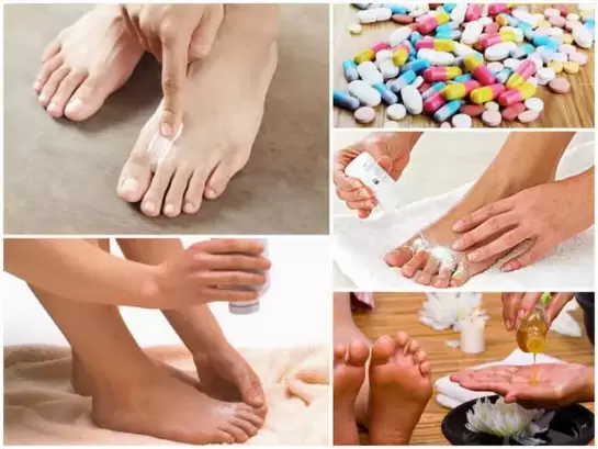 how to treat fungus between the toes