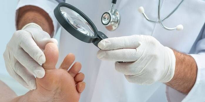 the doctor checks the feet for fungus between the toes